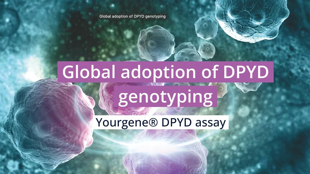 Global adoption of DPYD genotyping